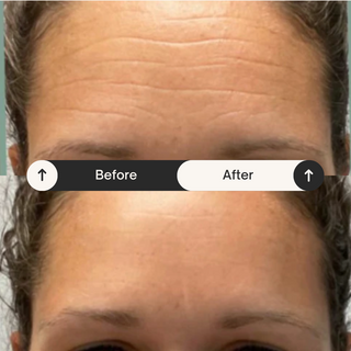 Beauty tape